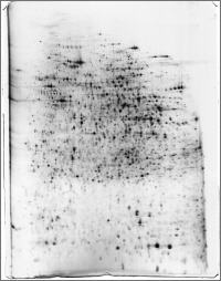 2DE gel stained by MS compatible FireSilver