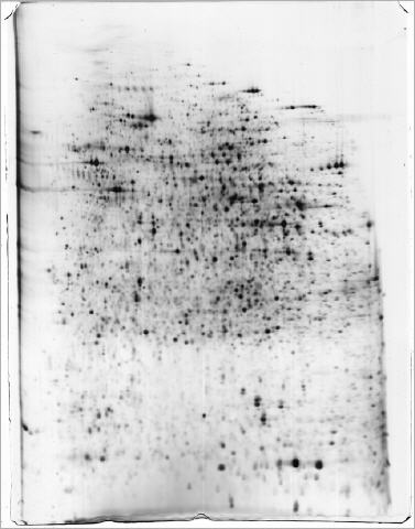 2DE gel stained by MS compatible FireSilver